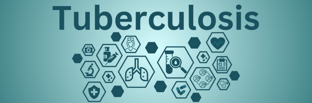Tuberculosis edited